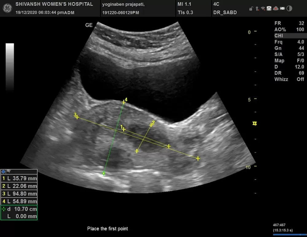 SHIVANSH WOMEN'S HOSPITAL AND COSMETIC SKIN CLINIC - Photo 6