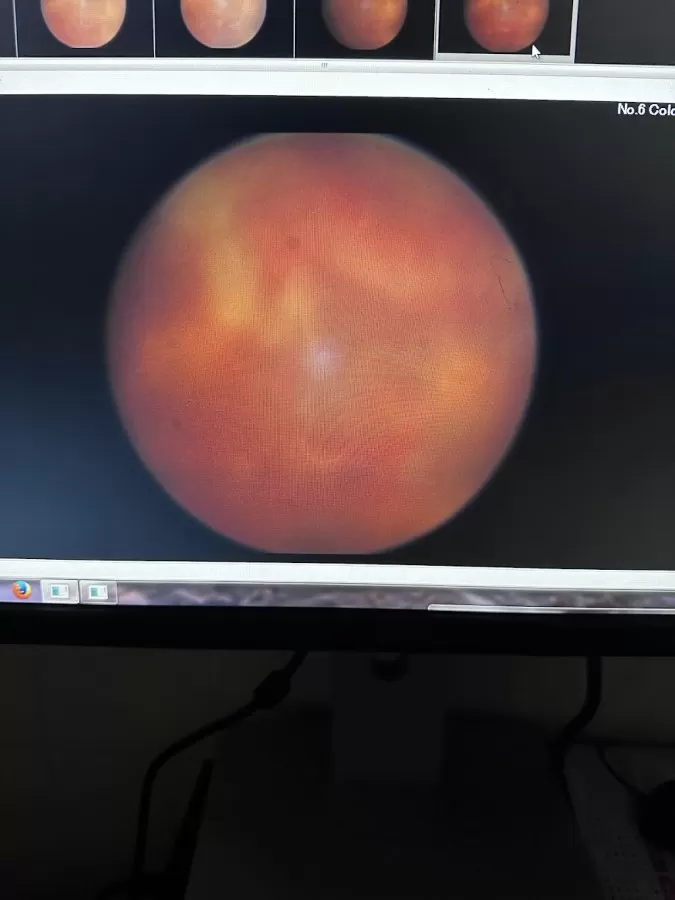 Sudhalkar Eye Hospital and Retina Centre - Photo 8