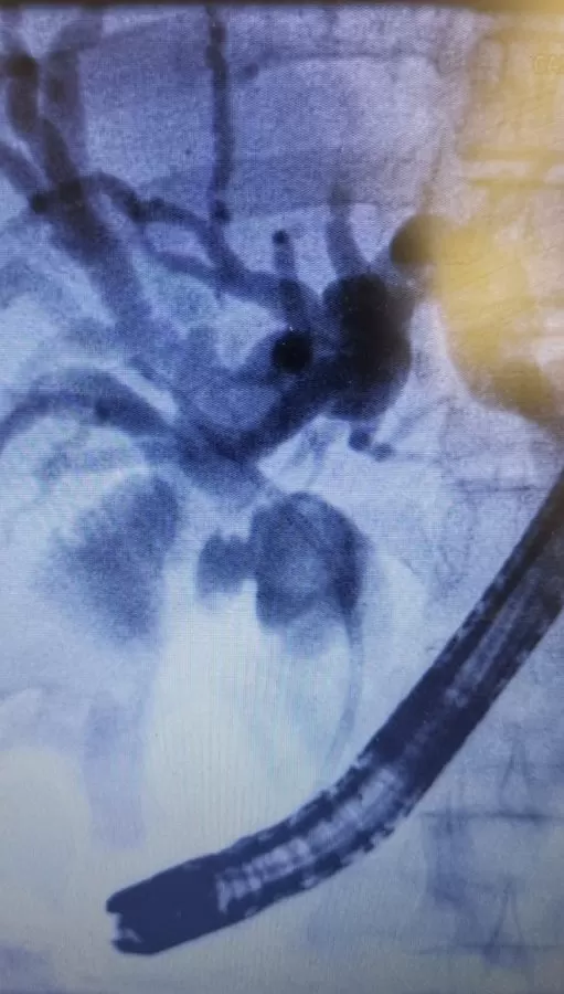 Gallstones, Hernias, Reflux, Gastric Cancer, Weight Loss Surgery & Endoscopy - Dr Toh Bin Chet Resurgence Surgical Clinic - Photo 5