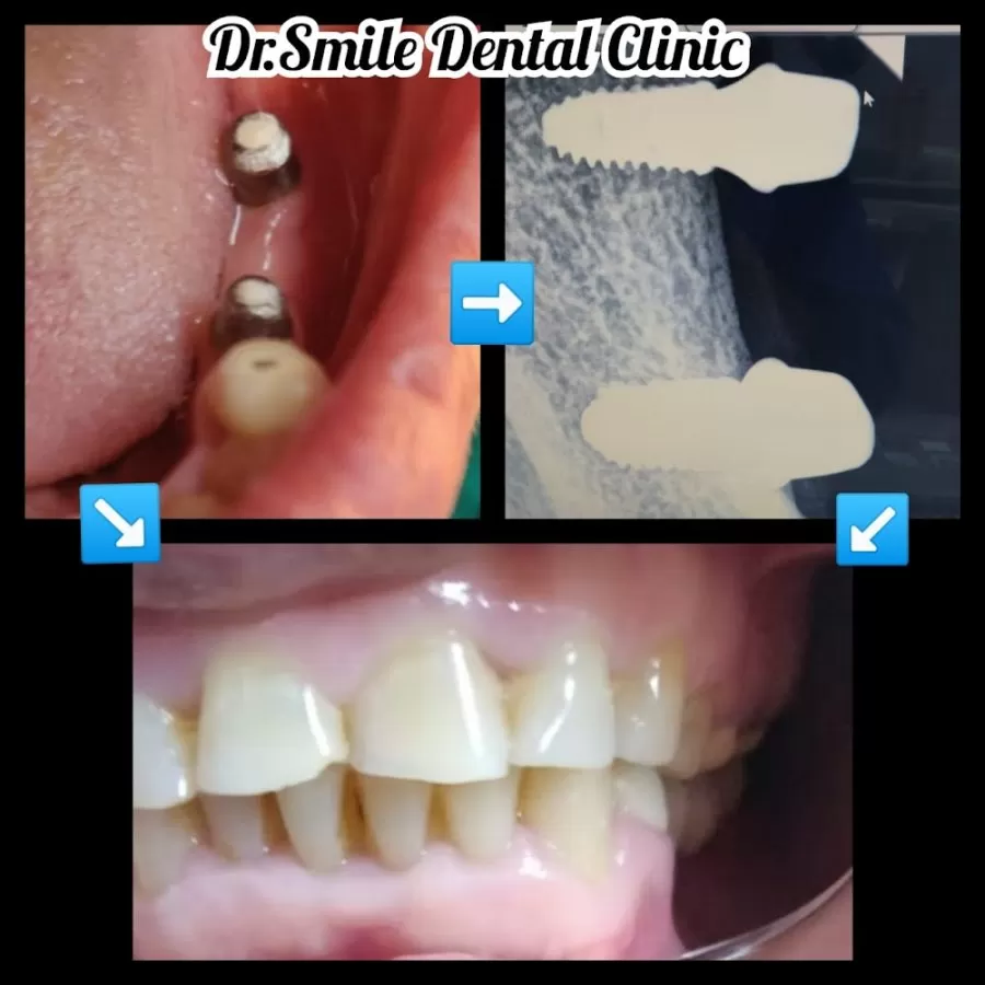 Dr smile Dental Clinic - Photo 8