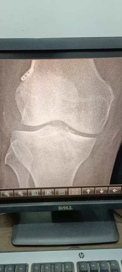 Atharva Orthopaedic Super Speciality Hospital | Dr. Prateek Joshi - Photo 8