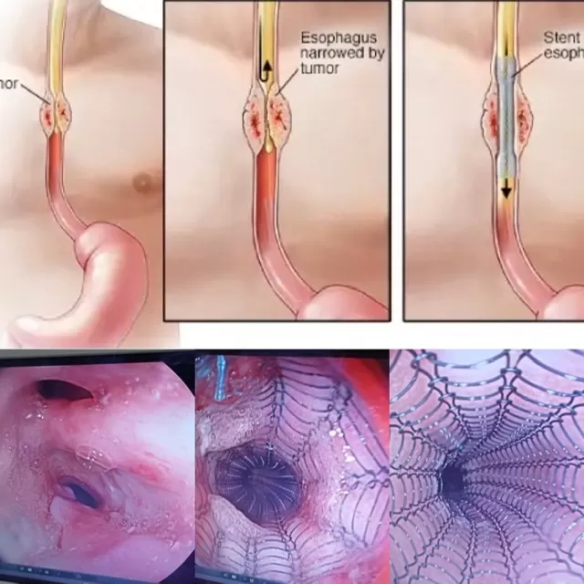Dr. Neil Palkhiwala MD DM MRCP - Interventional Gastro and Hepatologist - Photo 7