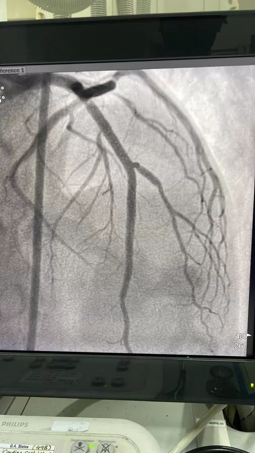 Dr. Rahul Patil | Best Cardiologist in Pune | Heart Doctor in Pune | Heart Clinic - Photo 3