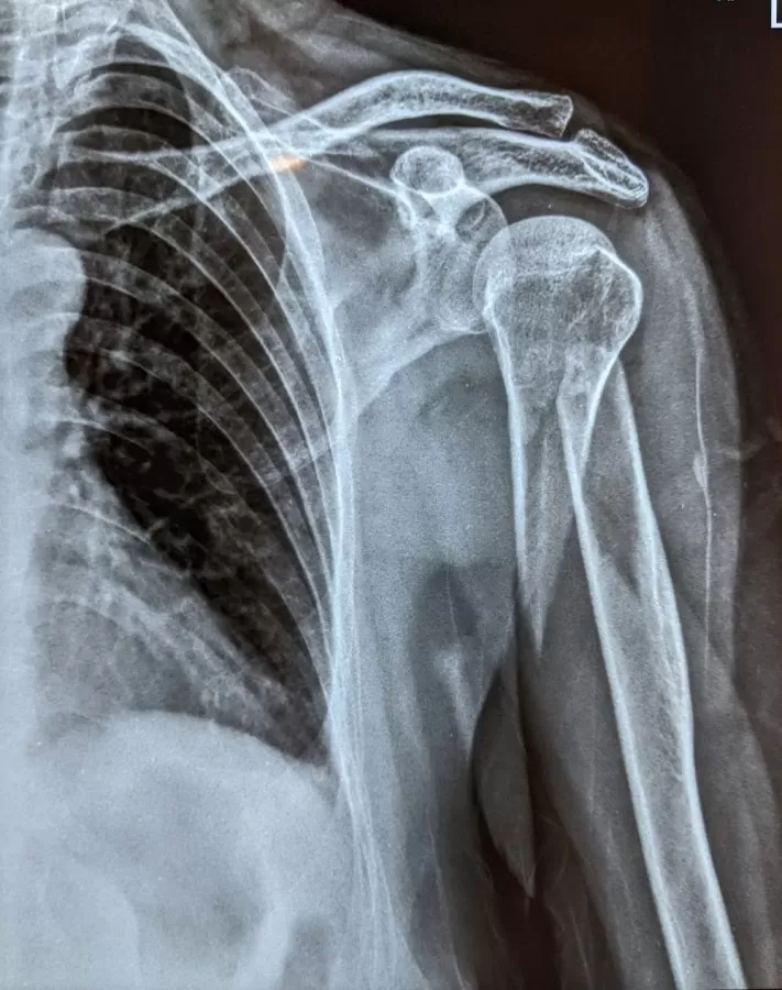 Noble Hospital - Orthopedic & Joint Replacement and Skin-Hair-Laser Centre South Bopal - Photo 3
