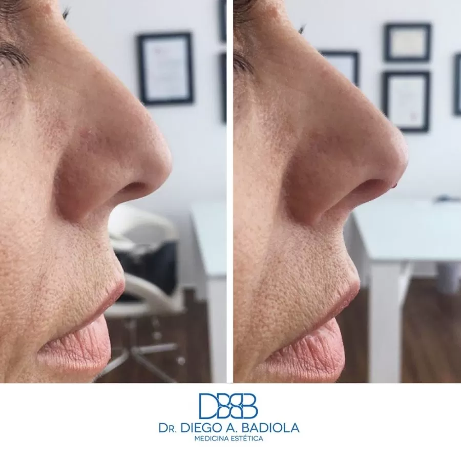 Clínica Dr. Badiola - Medicina Estética - Photo 3