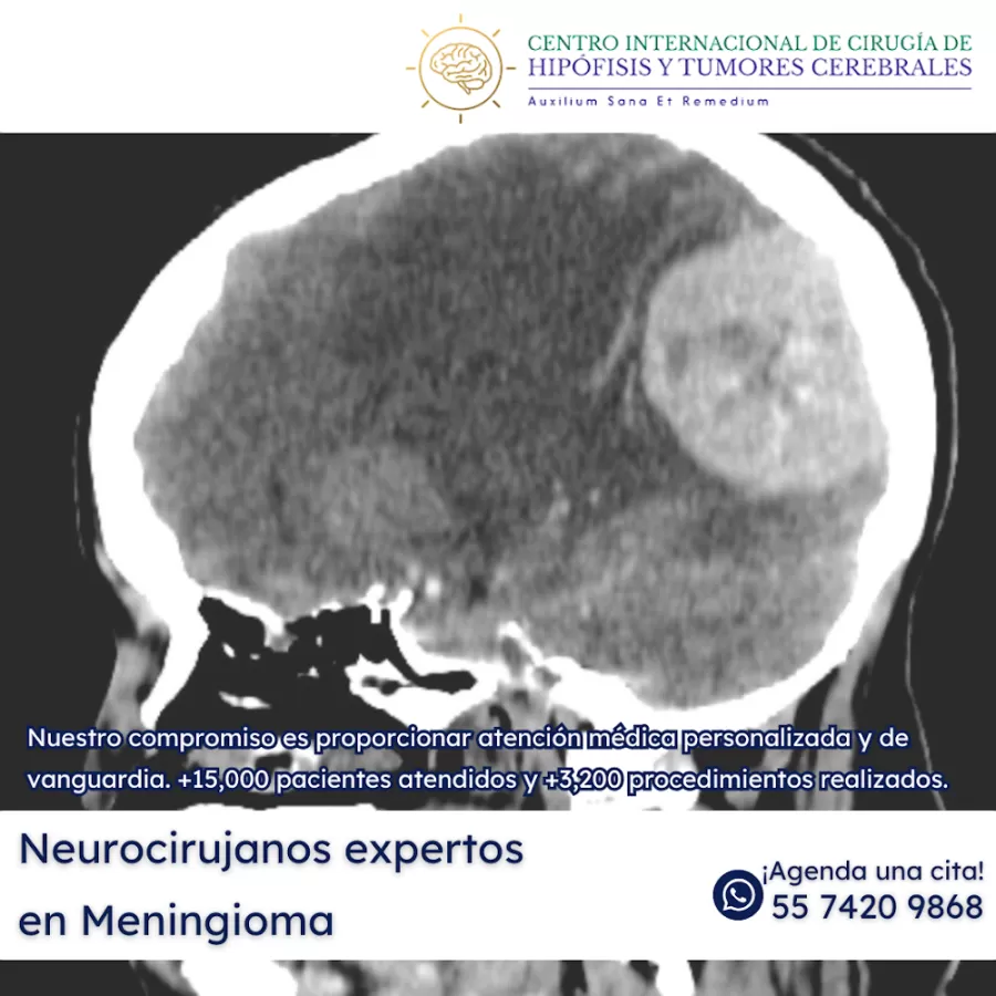 Hospital de Neurocirugía en CDMX - C.I.N.O - Photo 8