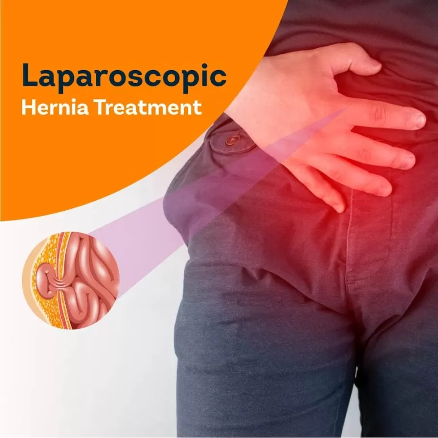 Pristyn Care DIYOS - Laparoscopy - Photo 6