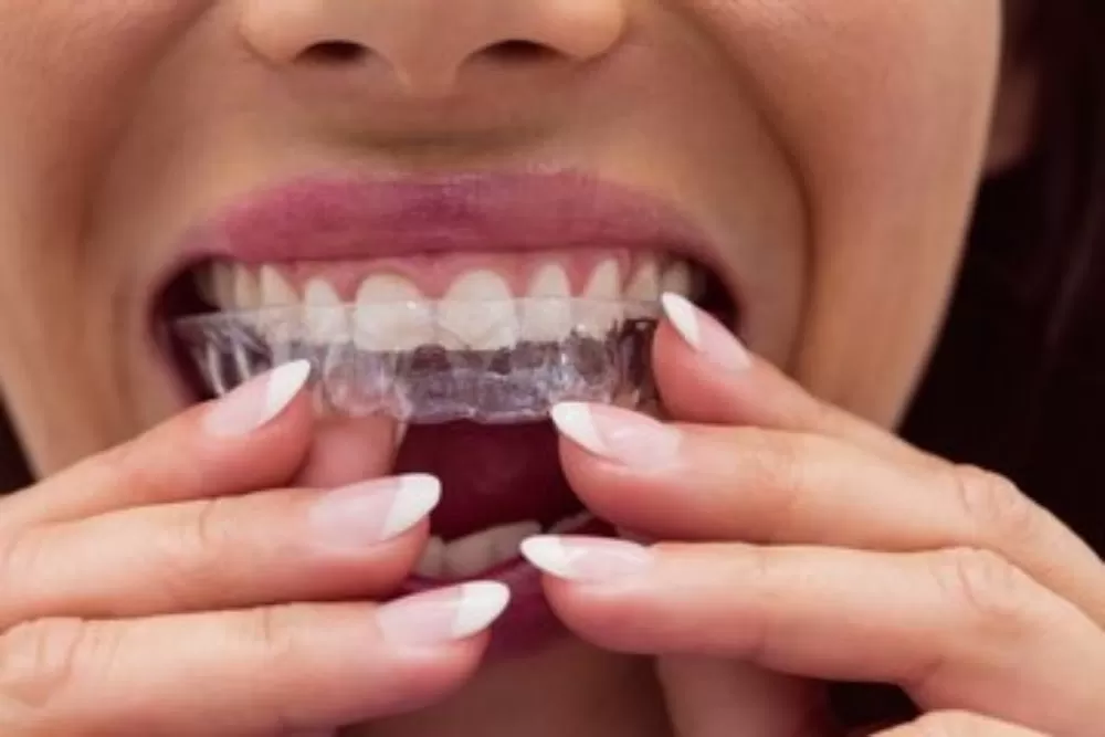 Best Dentist - Dr. Saket | Apollo Hospitals | Chennai - Photo 1