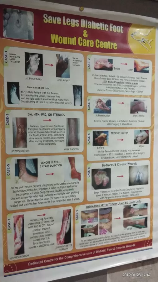 SAVE LEGS DIABETIC FOOT CLINIC - PODIATRISTS - Photo 3
