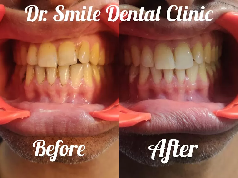 Dr smile Dental Clinic - Photo 2