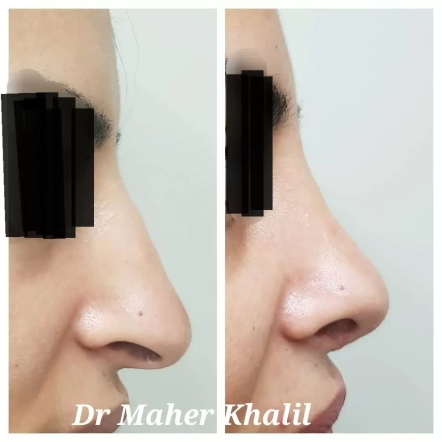 Dr. Maher Khalil German consultant. Best ENT Dubai - Photo 8