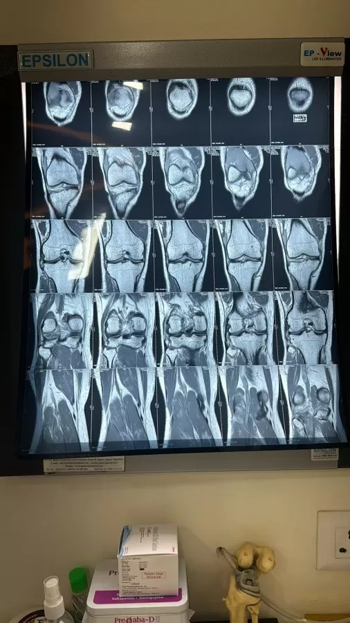 Dr Naveen Sharma / Advance orthopedic and sports injury hospital /AOSIH - Photo 3