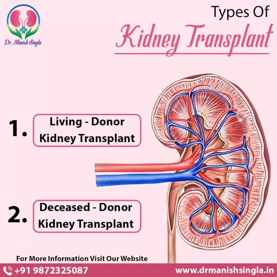 Dr. Manish Singla - Nephrologist Chandigarh/Mohali/Panchkula/punjab - Photo 4