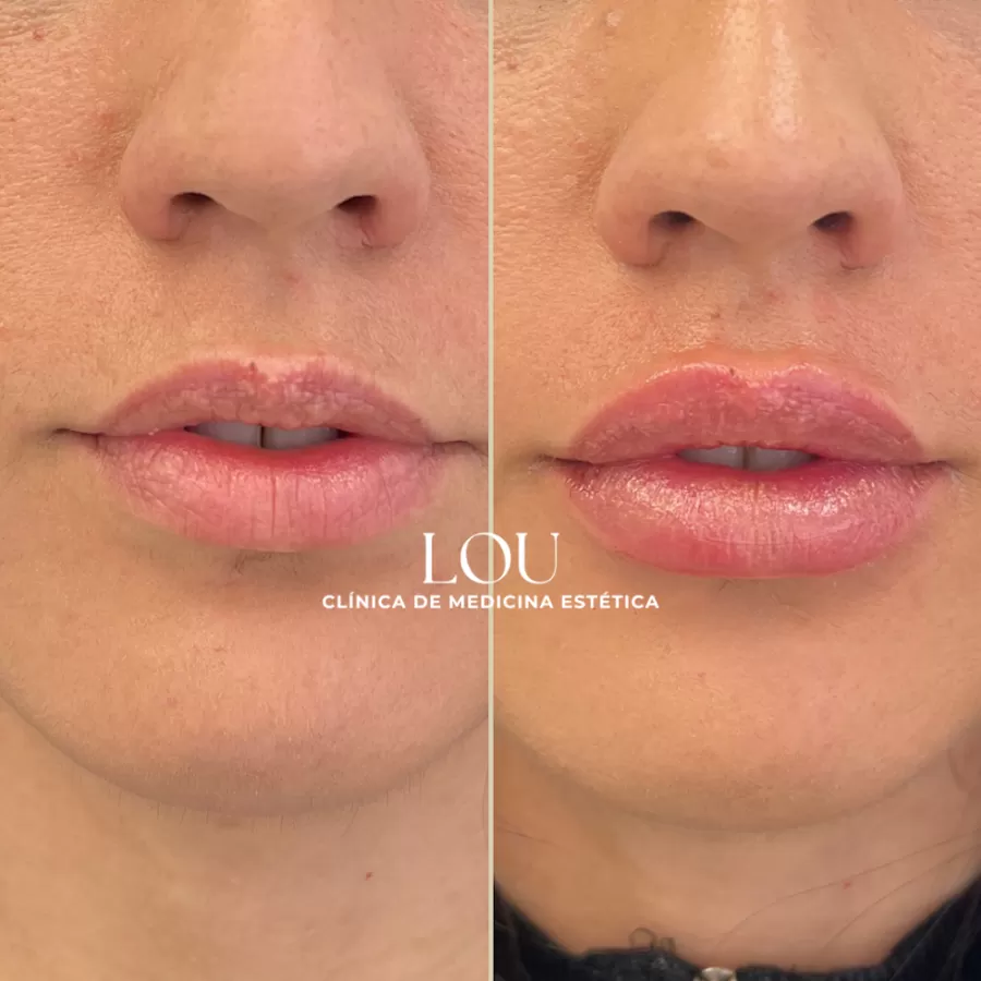 Clínica Lou - Medicina Estética - Photo 7