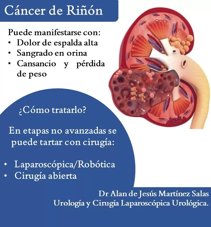 Dr. Alan de Jesus Martínez Salas - Urólogo - Photo 7