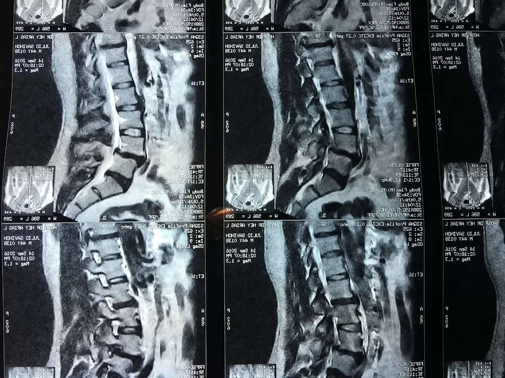 Unidad de Columna Vertebral Dr. Julio Angel García. Diagnóstico y Tratamiento. Centro Médico Dominicano - Photo 7