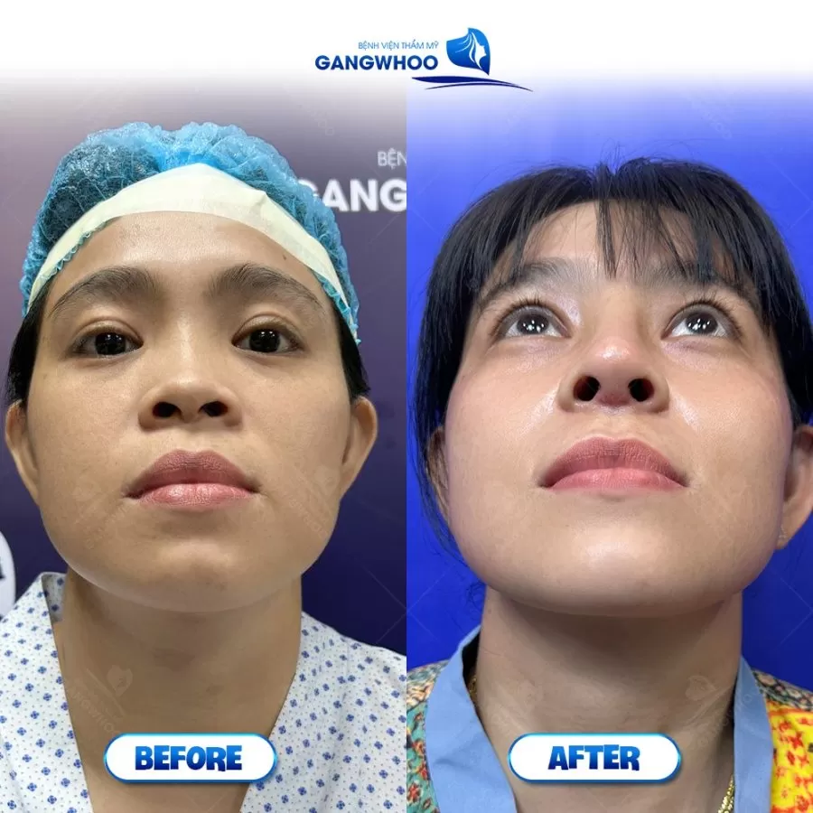 Gangwhoo Cosmetic Hospital - Photo 3