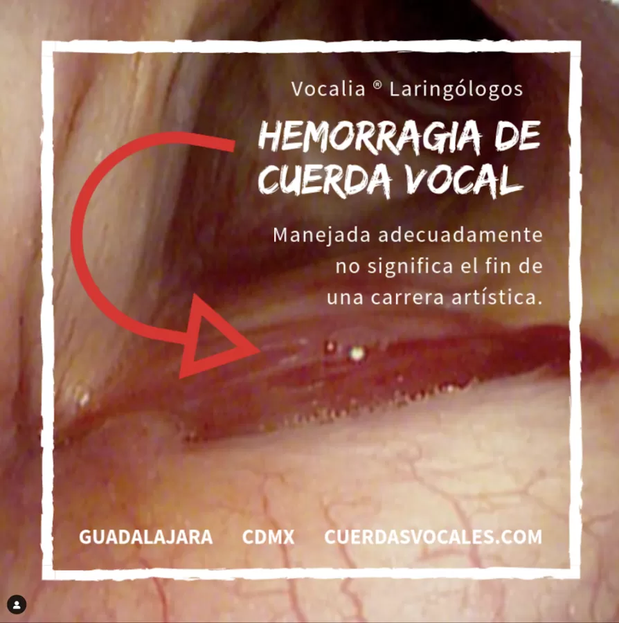 Vocalia Otorrinolaringólogos ® Oídos, Nariz y Garganta, Laringología y Trastornos de la Voz - Dr. Gerardo López Guerra - Photo 5