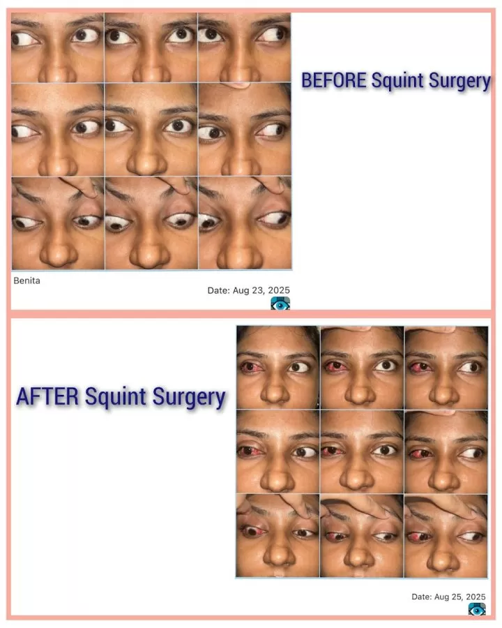 CEDS Eye Hospital | Unit of Dr Agarwals Eye Hospital - Bandra West, Mumbai - Photo 7