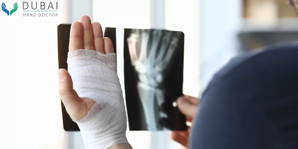 Dr. Ehab Aldlyami Wrist & Hand Surgeon In Dubai | Best Orthopedic Hand Doctor - Photo 5