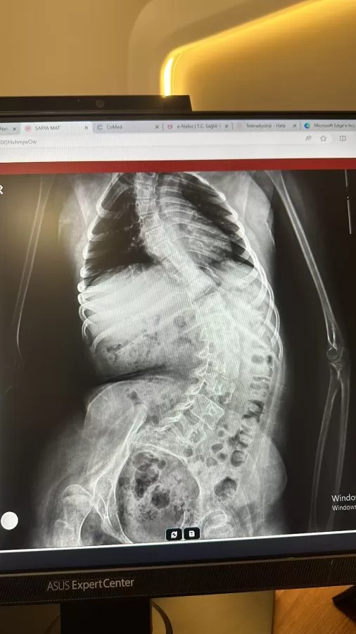 orthopedic surgery, spine surgery - Photo 7