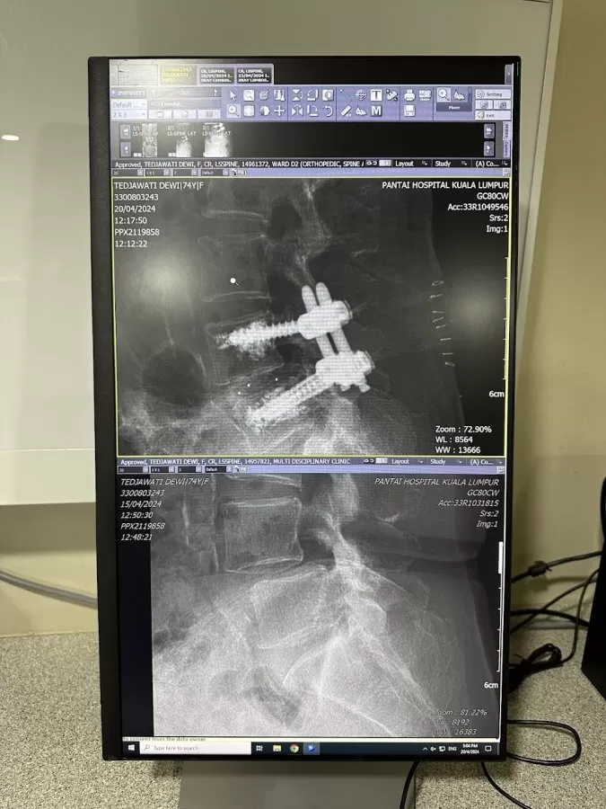 Dr. Sureisen Mariapan - Orthopaedic and Spine Care Clinic - Photo 5