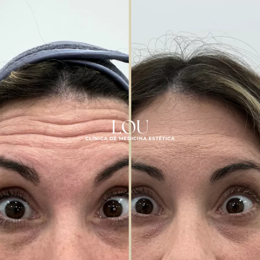 Clínica Lou - Medicina Estética - Photo 5
