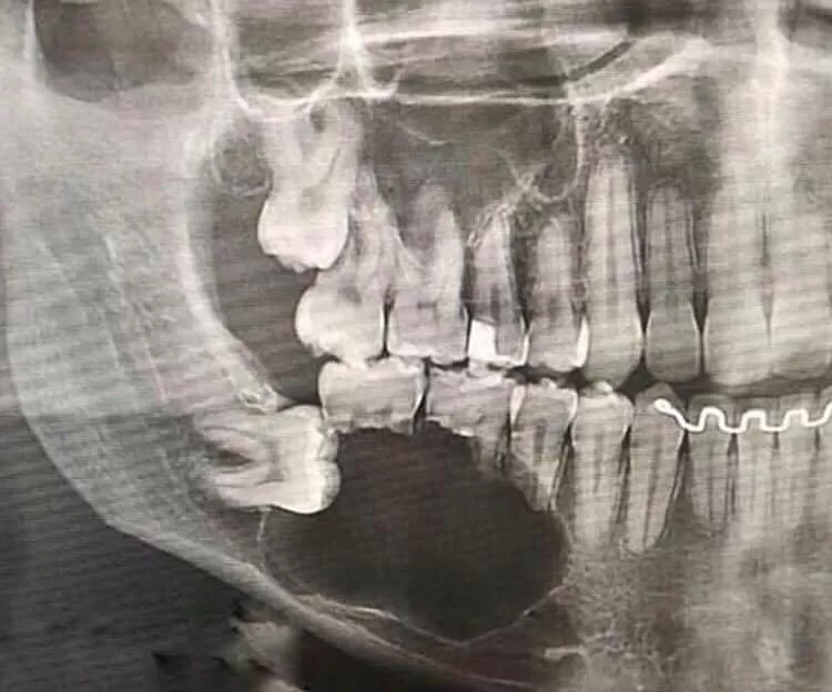 Dental universal - Photo 6