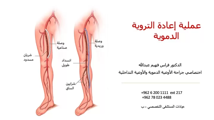 Dr. Feras Fahim Abdullah – Vascular Surgery - Photo 8