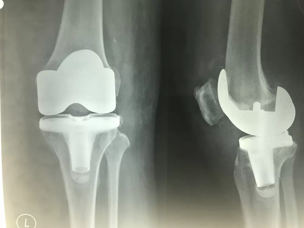 Dr Tan Chun Ee Orthopedic, Spine & Pain Intervention - Photo 3