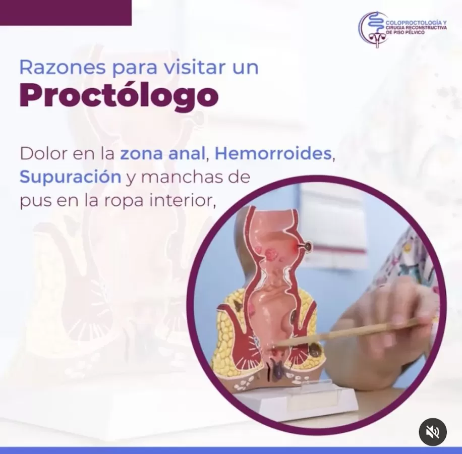 Médico Coloproctólogo y Cirugía de Piso Pélvico en Roma Sur, CDMX - Dr. Carlos Adrián Niño Carrasco - Photo 7