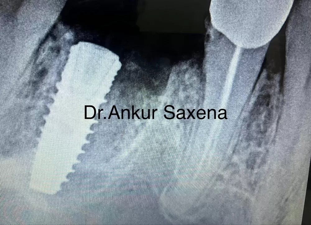 Noida Dental Hospital - Dental clinic | Dentist in Greater Noida - Photo 1