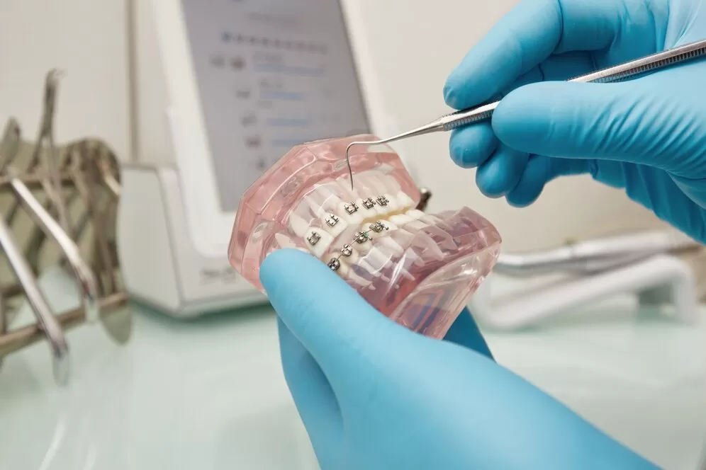 Best Dentist - Dr. Saket | Apollo Hospitals | Chennai - Photo 4