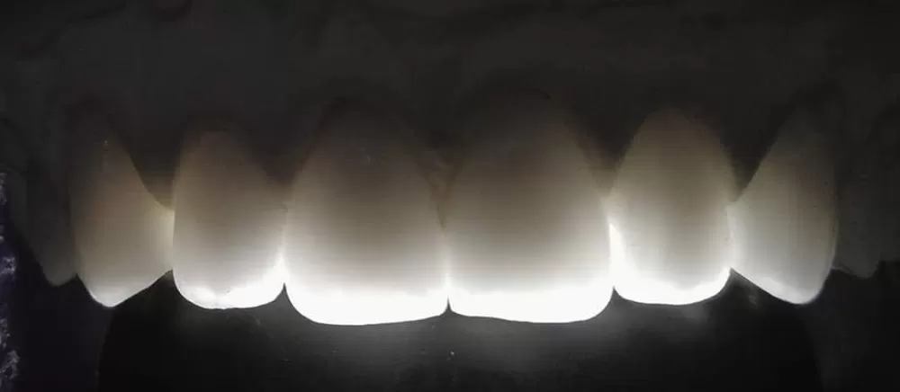 Nha Khoa Green Dental - Photo 8