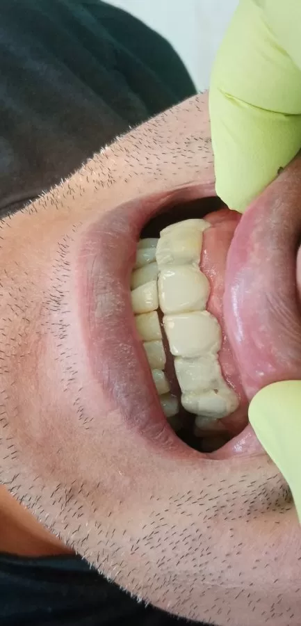 Dental universal - Photo 3