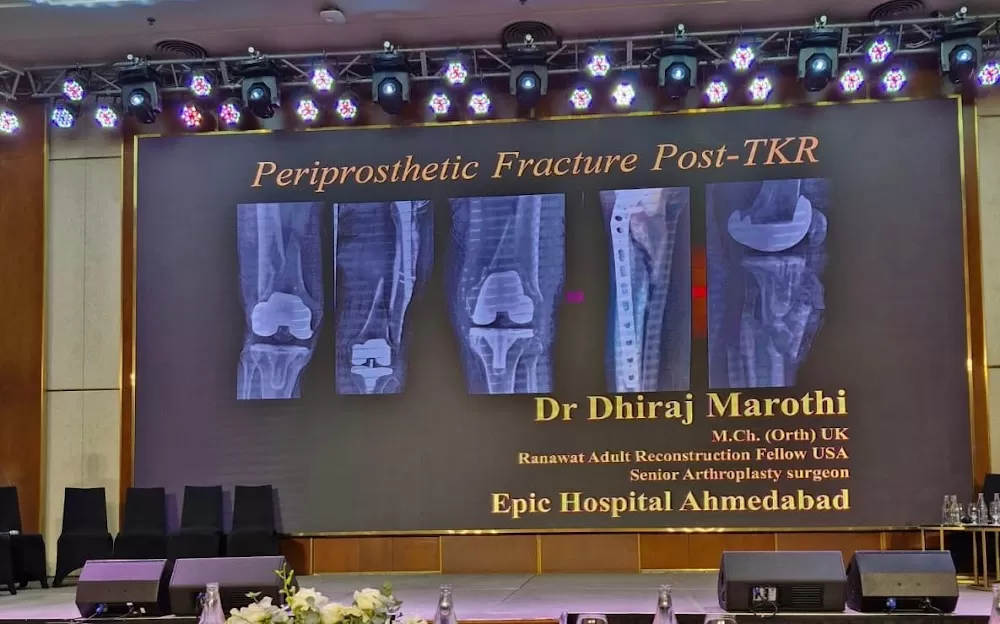Race Knee Clinic - Dr. Dhiraj Marothi - Photo 7