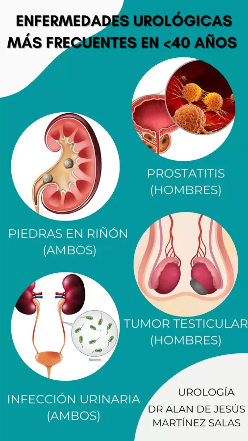 Dr. Alan de Jesus Martínez Salas - Urólogo - Photo 6