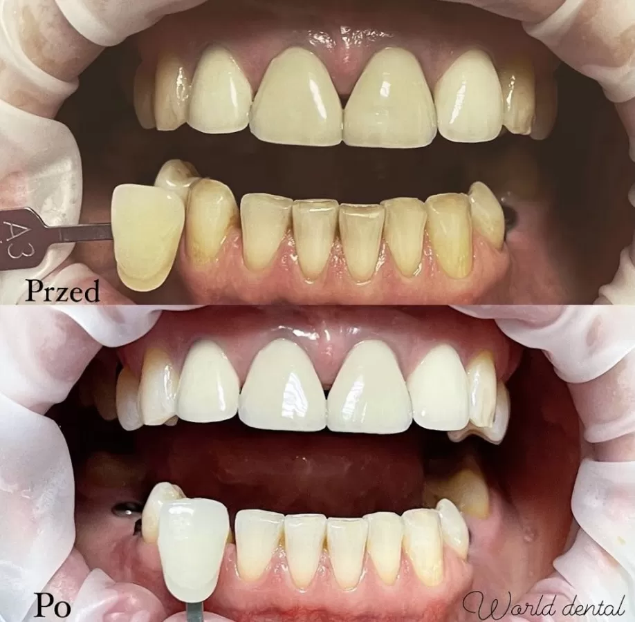 NZOZ World Dental - Photo 7