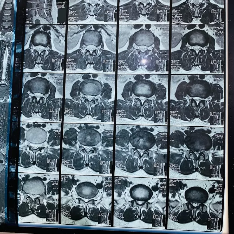 JPRC Neuro Spine Centre - Photo 4