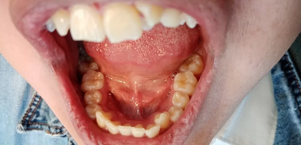 Dental universal - Photo 4