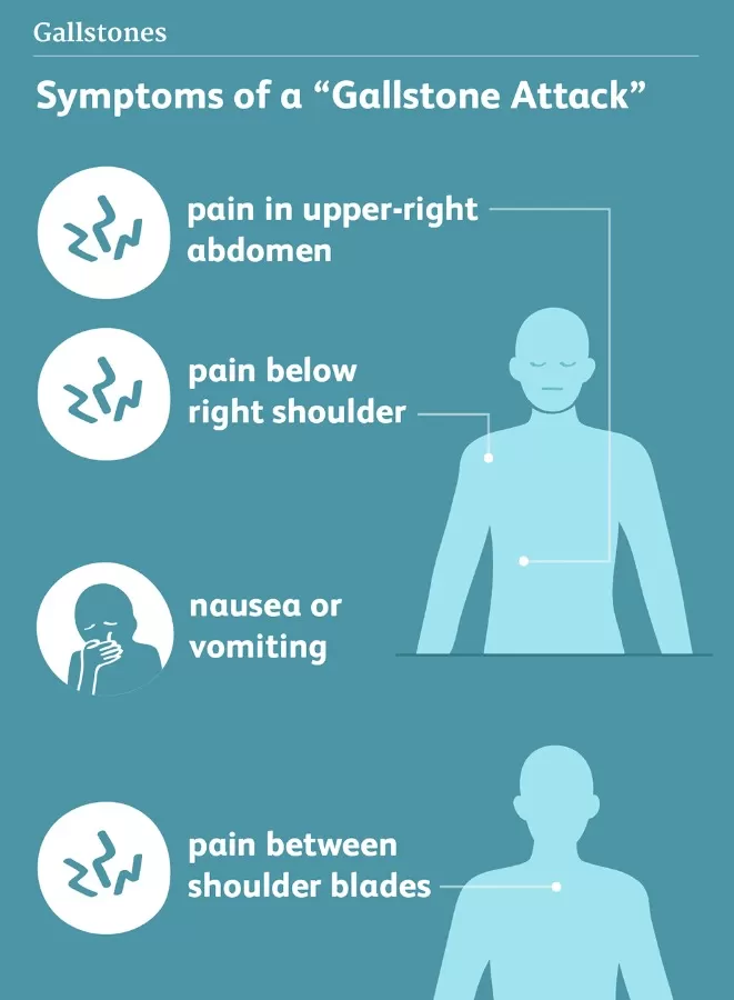 Gallstones, Hernias, Reflux, Gastric Cancer, Weight Loss Surgery & Endoscopy - Dr Toh Bin Chet Resurgence Surgical Clinic - Photo 1