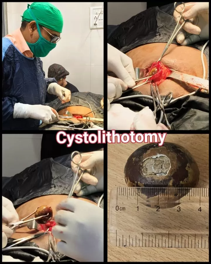 Varad Piles & Proctology Surgical Unit | Dr.Ramesh ahire MS (Shalya) General Surgeon & Proctologist | Nashik - Photo 6