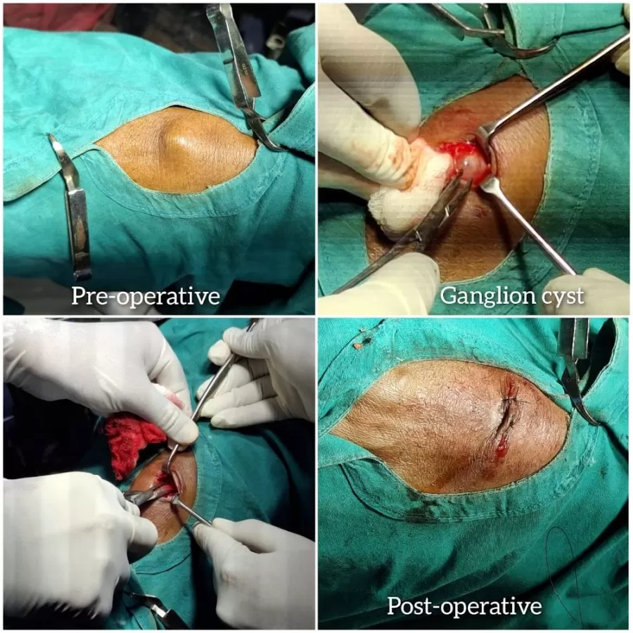 Varad Piles & Proctology Surgical Unit | Dr.Ramesh ahire MS (Shalya) General Surgeon & Proctologist | Nashik - Photo 4