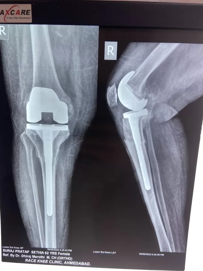 Race Knee Clinic - Dr. Dhiraj Marothi - Photo 1
