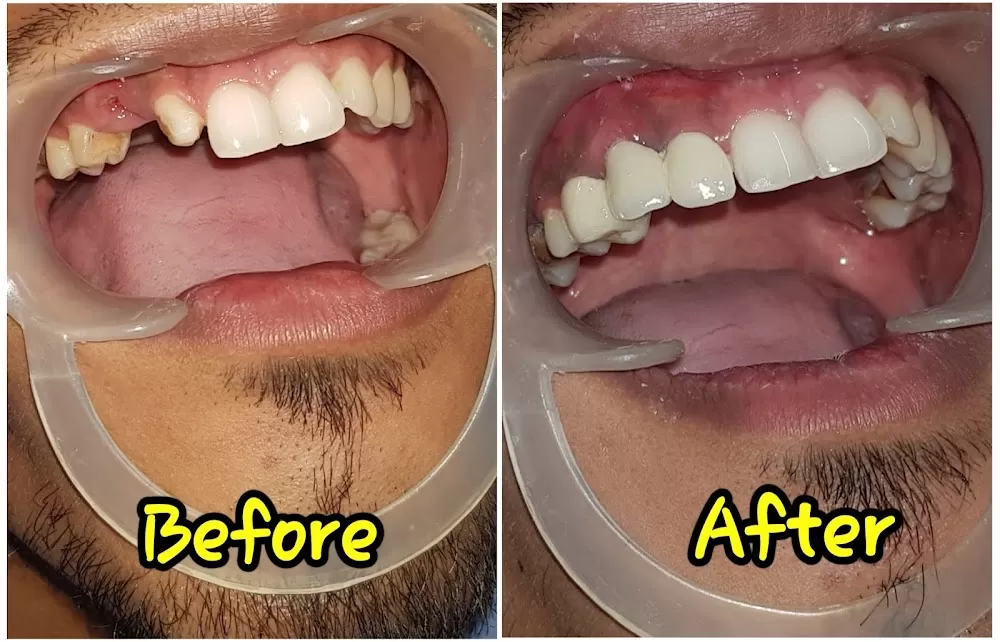 Dental Hub Clinic - Dr.Bhagyashree Mahale - Photo 2