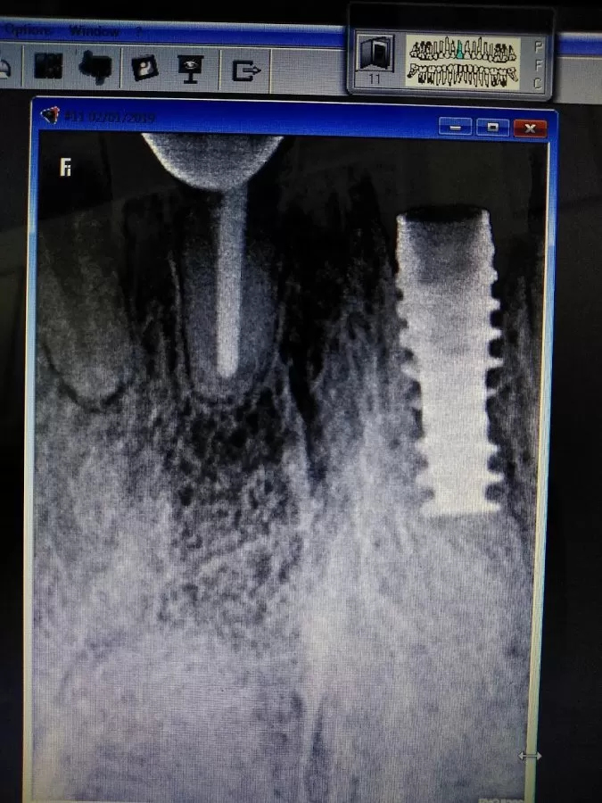 Choudhary's dental Hospital - Photo 8