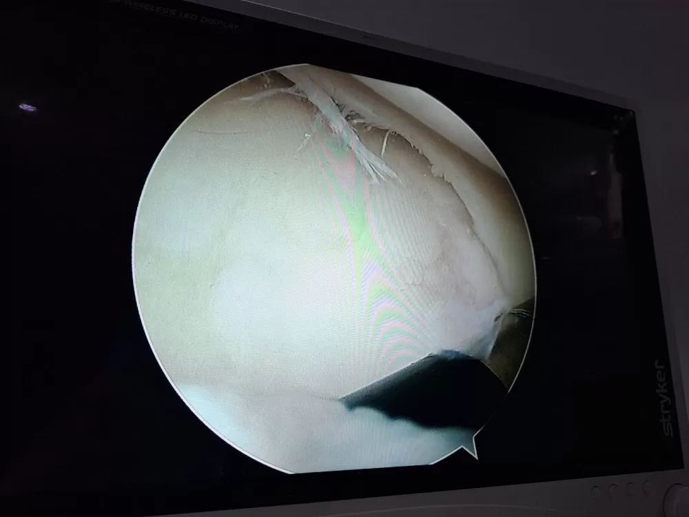 Dr. Edwin Acosta Traumatólogo - Ortopedista - Artroscopista - Photo 4
