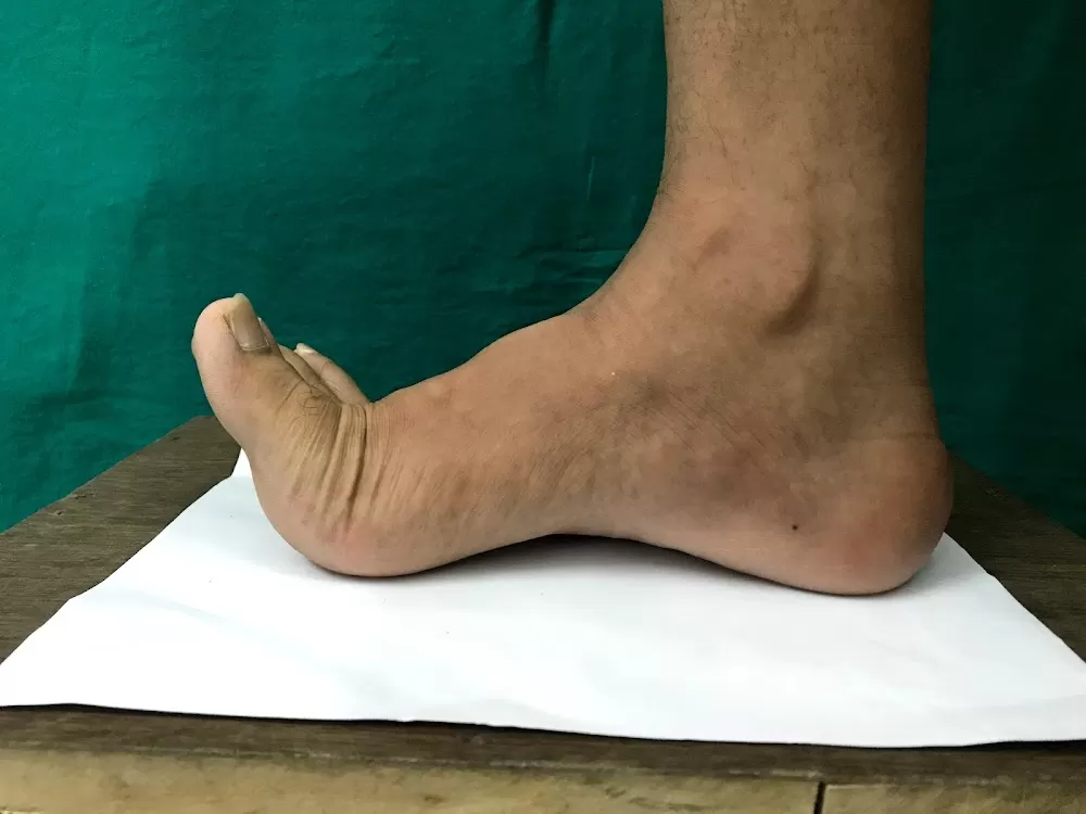Foot Clinic & Custom made Insole in Delhi NCR | Gurugram - Noida - Faridabad - Ghaziabad - Photo 3