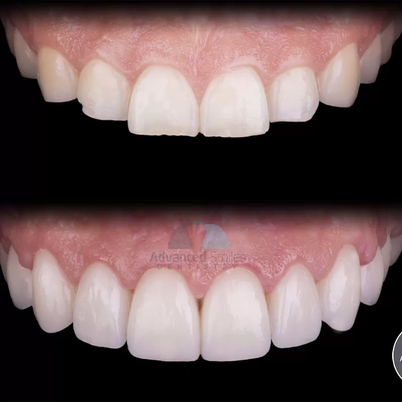 Advanced Smiles Dentistry - Photo 7