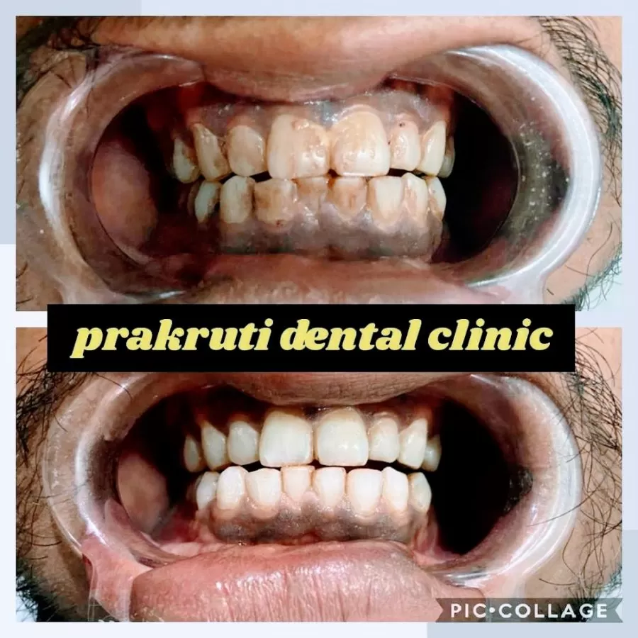 Prakruti Dental Clinic - Photo 8
